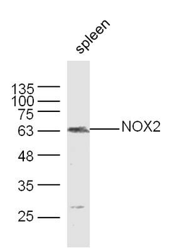 NOX2 Rabbit Polyclonal Antibody