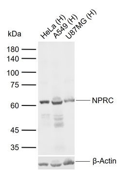 NPRC Rabbit Polyclonal Antibody