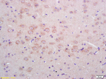 Phospho-NMDAR1 (Ser890) Rabbit Polyclonal Antibody