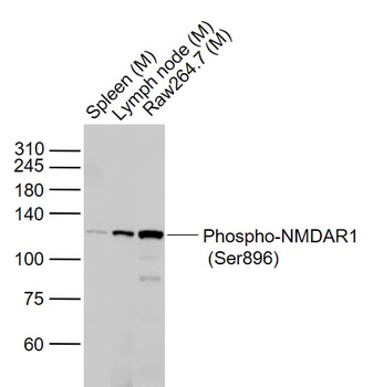 Phospho-NMDAR1 (Ser896) Rabbit Polyclonal Antibody
