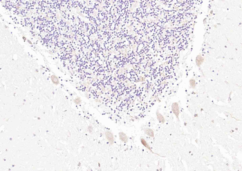 Phospho-Gria2 (Ser880) Rabbit Polyclonal Antibody