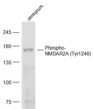Phospho-NMDAR2A (Tyr1246) Rabbit Polyclonal Antibody