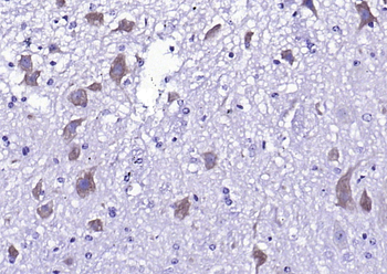 Phospho-NMDAR2A (Tyr1325) Rabbit Polyclonal Antibody