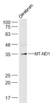 MT-ND1 Rabbit Polyclonal Antibody