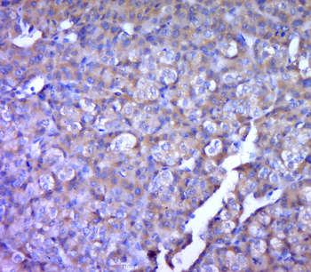 MT-ND5 Rabbit Polyclonal Antibody