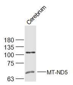 MT-ND5 Rabbit Polyclonal Antibody