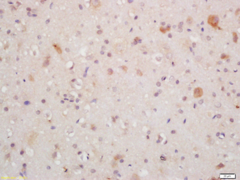 MT-ND5 Rabbit Polyclonal Antibody