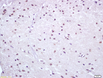 Nur77 Rabbit Polyclonal Antibody