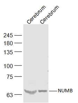 NUMB Rabbit Polyclonal Antibody
