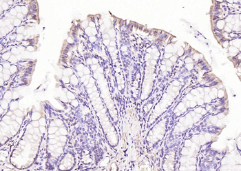 OCT2 Rabbit Polyclonal Antibody