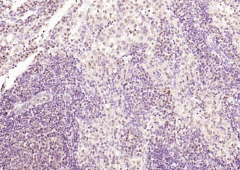 OCT2 Rabbit Polyclonal Antibody