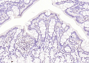 OCT2 Rabbit Polyclonal Antibody
