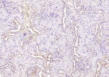 OCT2 Rabbit Polyclonal Antibody
