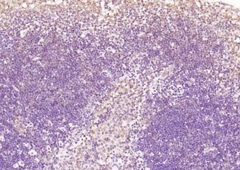 OCT2 Rabbit Polyclonal Antibody