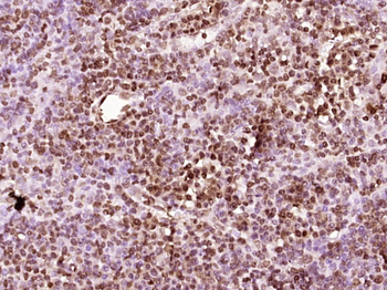 OCT2 Rabbit Polyclonal Antibody