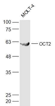 OCT2 Rabbit Polyclonal Antibody
