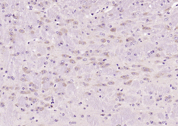 Oct-4B/OCT4B-190 Rabbit Polyclonal Antibody