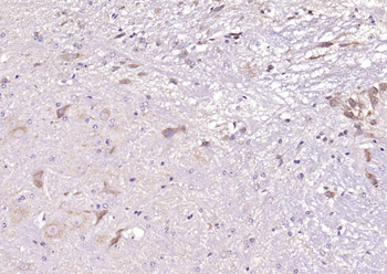 Oct-4B/OCT4B-190 Rabbit Polyclonal Antibody