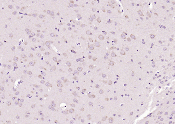 Oct-4B/OCT4B-190 Rabbit Polyclonal Antibody