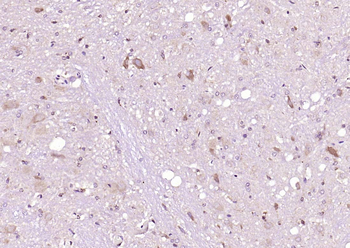 Oct-4B/OCT4B-190 Rabbit Polyclonal Antibody