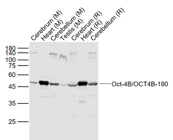 Oct-4B/OCT4B-190 Rabbit Polyclonal Antibody
