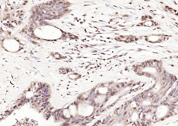 Phospho-CDKN1A/p21 (Thr145) Rabbit Polyclonal Antibody