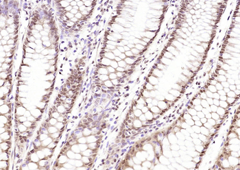 Phospho-CDKN1A/p21 (Thr145) Rabbit Polyclonal Antibody