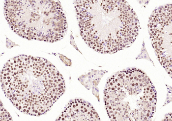 Phospho-CDKN1A/p21 (Thr145) Rabbit Polyclonal Antibody