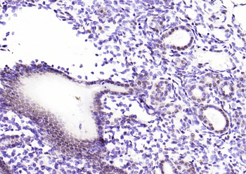 Phospho-CDKN1A/p21 (Thr145) Rabbit Polyclonal Antibody