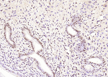 Phospho-CDKN1A/p21 (Thr145) Rabbit Polyclonal Antibody