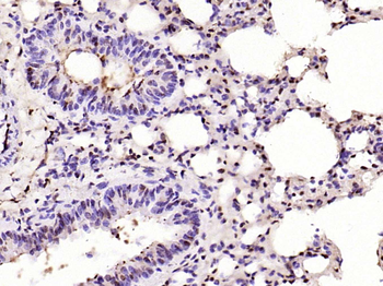 Phospho-CDKN1A/p21 (Thr57) Rabbit Polyclonal Antibody