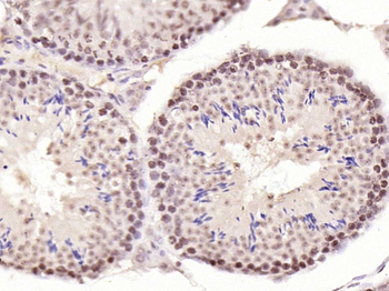 Phospho-CDKN1A/p21 (Thr57) Rabbit Polyclonal Antibody