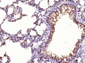 Phospho-CDKN1A/p21 (Thr57) Rabbit Polyclonal Antibody