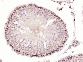 Phospho-CDKN1A/p21 (Thr57) Rabbit Polyclonal Antibody