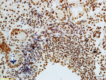 Phospho-CDKN1A/p21 (Thr57) Rabbit Polyclonal Antibody