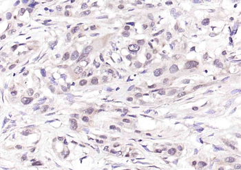 Phospho-CDKN1A/p21 (Ser130) Rabbit Polyclonal Antibody