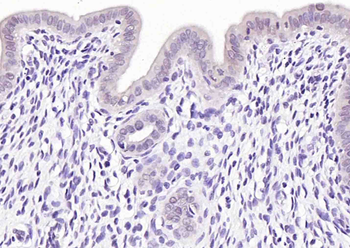 Phospho-CDKN1A/p21 (Ser130) Rabbit Polyclonal Antibody