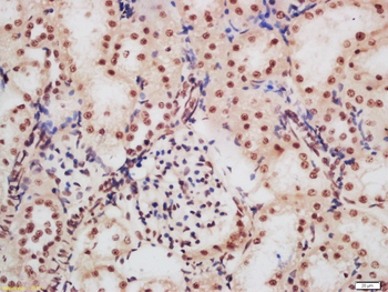 Phospho-CDKN1A/p21 (Ser130) Rabbit Polyclonal Antibody