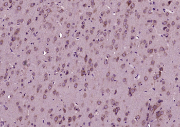 Phospho-CDKN1B (Thr187) Rabbit Polyclonal Antibody