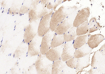 Phospho-CDKN1B (Thr198) Rabbit Polyclonal Antibody