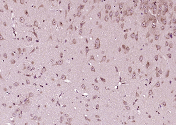Phospho-CDKN1B (Thr198) Rabbit Polyclonal Antibody