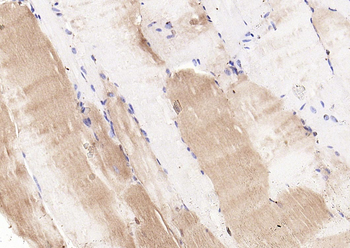 Phospho-CDKN1B (Thr198) Rabbit Polyclonal Antibody