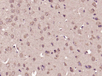 Phospho-p38 MAPK (Thr180 + Tyr182) Rabbit Polyclonal Antibody