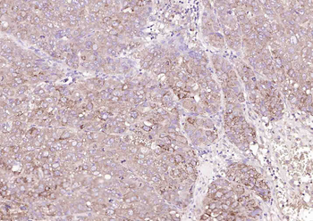 Phospho-MKK3 (Ser218) + MKK6 (Ser207) Rabbit Polyclonal Antibody