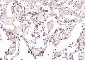 Phospho-MKK3 (Ser218) + MKK6 (Ser207) Rabbit Polyclonal Antibody