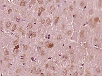 Phospho-MKK3 (Ser218) + MKK6 (Ser207) Rabbit Polyclonal Antibody