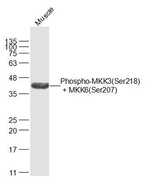 Phospho-MKK3 (Ser218) + MKK6 (Ser207) Rabbit Polyclonal Antibody