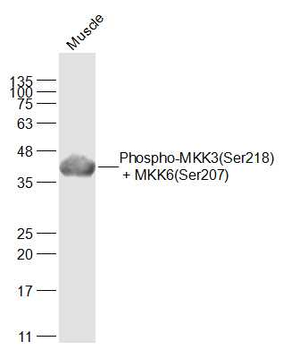 Phospho-MKK3 (Ser218) + MKK6 (Ser207) Rabbit Polyclonal Antibody