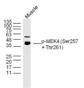 Phospho-MEK4 (Ser257 + Thr261) Rabbit Polyclonal Antibody