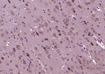 Phospho-MEK6 (Ser207) Rabbit Polyclonal Antibody